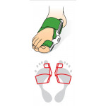 Svorto 023 Bandáž hallux valgus s kloubem