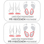 SVORTO 116 Gélové podpätenky asymetrické